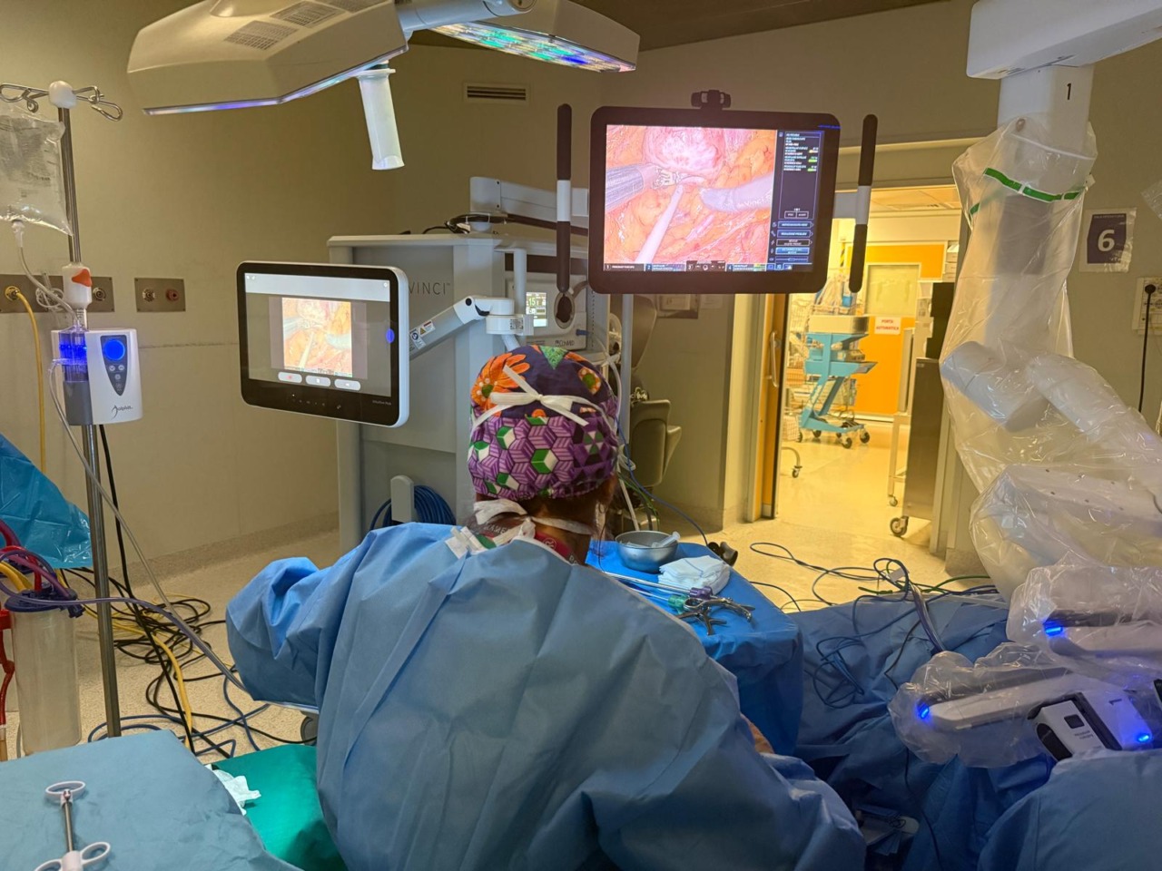 Chirurgia robotica: oltre 40 interventi in un mese